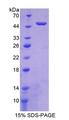 TNFSF11 / RANKL / TRANCE Protein - Recombinant Receptor Activator Of Nuclear Factor Kappa B Ligand By SDS-PAGE