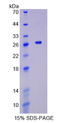 TNFSF9 / CD137L Protein - Recombinant  Tumor Necrosis Factor Ligand Superfamily, Member 9 By SDS-PAGE