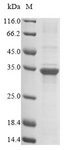 TNNI1 Protein - (Tris-Glycine gel) Discontinuous SDS-PAGE (reduced) with 5% enrichment gel and 15% separation gel.