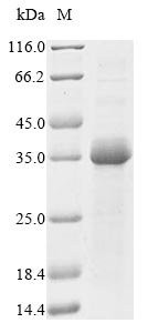 TNNI2 Protein - (Tris-Glycine gel) Discontinuous SDS-PAGE (reduced) with 5% enrichment gel and 15% separation gel.