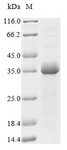 TNNI2 Protein - (Tris-Glycine gel) Discontinuous SDS-PAGE (reduced) with 5% enrichment gel and 15% separation gel.