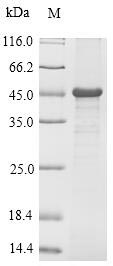 TNNI3 / Cardiac Troponin I Protein - (Tris-Glycine gel) Discontinuous SDS-PAGE (reduced) with 5% enrichment gel and 15% separation gel.