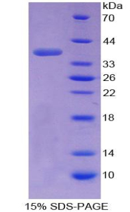 TNP1 / TP1 Protein - Recombinant Transition Protein 1 By SDS-PAGE