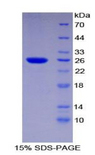 TNPO1 / Transportin 1 Protein - Recombinant Transportin 1 By SDS-PAGE