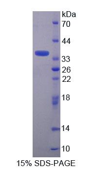 TNRC6A / GW182 Protein - Recombinant Trinucleotide Repeat Containing Protein 6A By SDS-PAGE