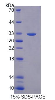 TNXB / Tenascin XB Protein - Recombinant Tenascin X By SDS-PAGE