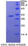 TOLLIP Protein - Recombinant Toll Interacting Protein By SDS-PAGE