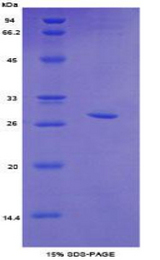 TOP2B / Topoisomerase II Beta Protein - Recombinant Topoisomerase II Beta By SDS-PAGE