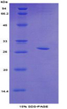 TOP2B / Topoisomerase II Beta Protein - Recombinant Topoisomerase II Beta By SDS-PAGE