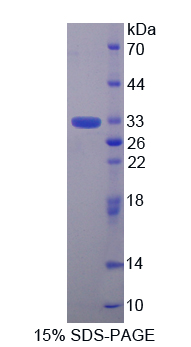 TOR1B / Torsin B Protein - Recombinant  Torsin 1B By SDS-PAGE