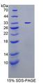 TP / Thymidine Phosphorylase Protein - Recombinant Thymidine Phosphorylase By SDS-PAGE