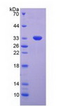 TP53 / p53 Protein - Recombinant Tumor Protein p53 By SDS-PAGE