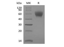 TPBG / 5T4 Protein - Recombinant Mouse TPBG/5T4 (C-6His)