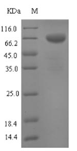TPH1 / Tryptophan Hydroxylase Protein - (Tris-Glycine gel) Discontinuous SDS-PAGE (reduced) with 5% enrichment gel and 15% separation gel.