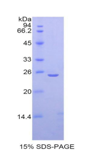 TPO / Thyroid Peroxidase Protein - Recombinant Thyroid Peroxidase By SDS-PAGE
