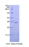 TPO / Thyroid Peroxidase Protein - Recombinant Thyroid Peroxidase By SDS-PAGE