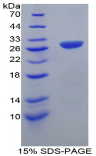TRAF1 Protein - Recombinant TNF Receptor Associated Factor 1 By SDS-PAGE
