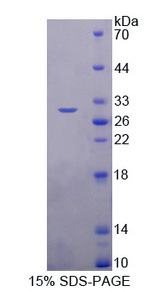 TRAF6 Protein - Recombinant  TNF Receptor Associated Factor 6 By SDS-PAGE