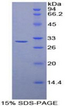 Transaldolase Protein - Recombinant Transaldolase By SDS-PAGE