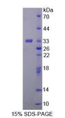 TREH Protein - Recombinant  Trehalase By SDS-PAGE