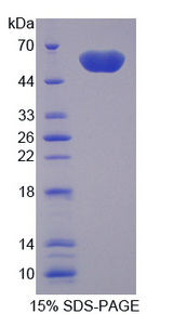 TREM2 / TREM-2 Protein - Recombinant Triggering Receptor Expressed On Myeloid Cells 2 By SDS-PAGE