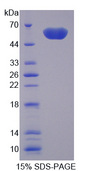 TREM2 / TREM-2 Protein - Recombinant Triggering Receptor Expressed On Myeloid Cells 2 By SDS-PAGE
