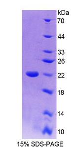 TRERF1 Protein - Recombinant Transcriptional Regulating Factor 1 By SDS-PAGE