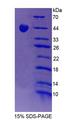 TROVE2 Protein - Recombinant Sjogren Syndrome Antigen A2 (SSA2) by SDS-PAGE