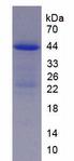 TSLP Protein - Recombinant Thymic Stromal Lymphopoietin By SDS-PAGE