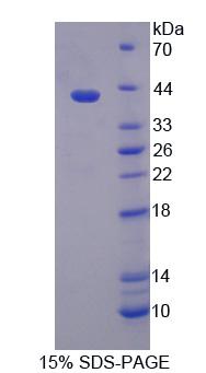 TSTA3 /  GDP-L-Fucose Synthase Protein - Recombinant Tissue Specific Transplantation Antigen P35B By SDS-PAGE