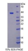 TSTA3 /  GDP-L-Fucose Synthase Protein - Recombinant Tissue Specific Transplantation Antigen P35B By SDS-PAGE