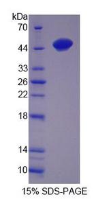 TTPA Protein - Recombinant Alpha-Tocopherol Transfer Protein By SDS-PAGE