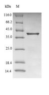 TTR / Transthyretin Protein - (Tris-Glycine gel) Discontinuous SDS-PAGE (reduced) with 5% enrichment gel and 15% separation gel.