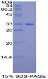 TUBB1 / Tubulin Beta 1 Protein - Recombinant Tubulin Beta 1 By SDS-PAGE