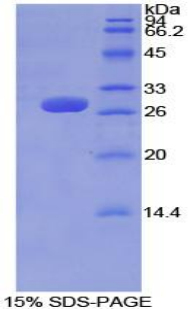 TUBD1 / Tubulin Delta Protein - Recombinant Tubulin Delta By SDS-PAGE