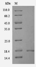TXNDC12 Protein - (Tris-Glycine gel) Discontinuous SDS-PAGE (reduced) with 5% enrichment gel and 15% separation gel.