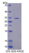 TYK2 Protein - Recombinant Tyrosine Kinase 2 By SDS-PAGE