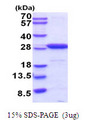 UCHL1 / PGP9.5 Protein