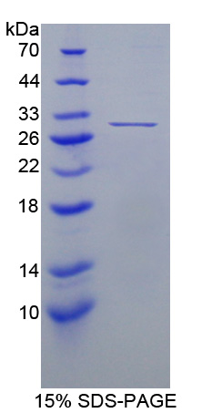 Uchl4 Protein - Recombinant  Ubiquitin Carboxyl Terminal Hydrolase L4 By SDS-PAGE