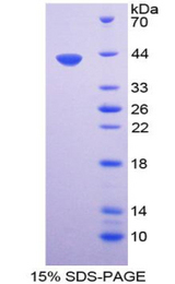 UCN / Urocortin Protein - Recombinant Urocortin 1 By SDS-PAGE