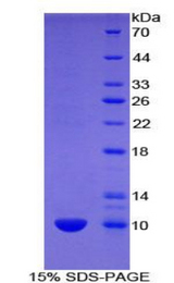 UCN2 / SRP Protein