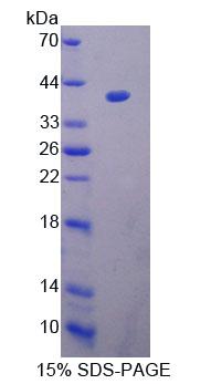 UP2 / UPP2 Protein - Recombinant Uridine Phosphorylase 2 (UPP2) by SDS-PAGE