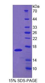 UPK1A / Uroplakin 1A Protein - Recombinant Uroplakin 1A By SDS-PAGE