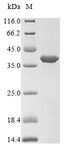 UPK2 / UPII / Uroplakin 2 Protein - (Tris-Glycine gel) Discontinuous SDS-PAGE (reduced) with 5% enrichment gel and 15% separation gel.
