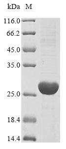 UPK3A / UPK3 / Uroplakin III Protein - (Tris-Glycine gel) Discontinuous SDS-PAGE (reduced) with 5% enrichment gel and 15% separation gel.