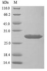 USAG1 / SOSTDC1 Protein - (Tris-Glycine gel) Discontinuous SDS-PAGE (reduced) with 5% enrichment gel and 15% separation gel.
