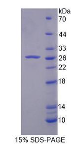 USP2 Protein - Recombinant Ubiquitin Specific Peptidase 2 (USP2) by SDS-PAGE