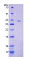 VARS / ValRS Protein - Recombinant Valyl tRNA Synthetase (VARS) by SDS-PAGE