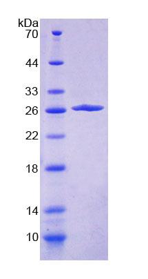 VAV1 / VAV Protein - Recombinant  Vav 1 Oncogene By SDS-PAGE