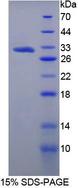 VCAN / Versican Protein - Recombinant Versican By SDS-PAGE